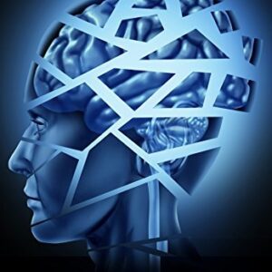 Brain Damage by Freida McFadden